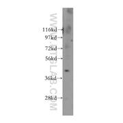 NEIL1 Rabbit Polyclonal Antibody (12145-1-AP)
