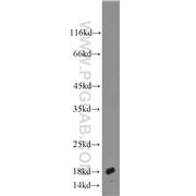 AGR2 Rabbit Polyclonal Antibody (12275-1-AP)