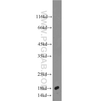 AGR2 Rabbit Polyclonal Antibody (12275-1-AP)