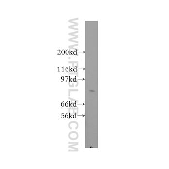 CRTC2 Rabbit Polyclonal Antibody (12497-1-AP)