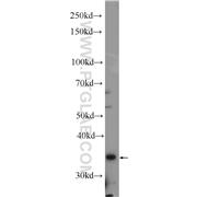 DBP Rabbit Polyclonal Antibody (12662-1-AP)