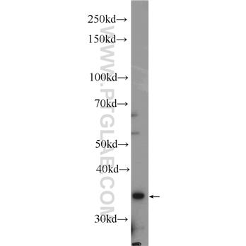 DBP Rabbit Polyclonal Antibody (12662-1-AP)