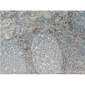 PLAC8 Rabbit Polyclonal Antibody (12284-1-AP)