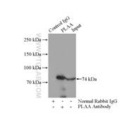 PLAA Rabbit Polyclonal Antibody (12529-1-AP)