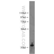 SFRP2 Rabbit Polyclonal Antibody (12189-1-AP)