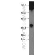 SSX5 Rabbit Polyclonal Antibody (12401-1-AP)