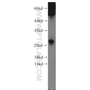 SSX5 Rabbit Polyclonal Antibody (12401-1-AP)