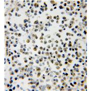 SMNDC1 Rabbit Polyclonal Antibody (12178-1-AP)