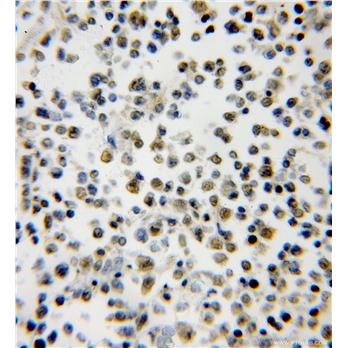 SMNDC1 Rabbit Polyclonal Antibody (12178-1-AP)