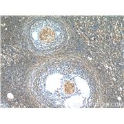 SH2B1 Rabbit Polyclonal Antibody (12226-1-AP)