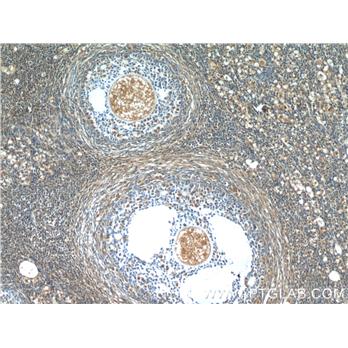 SH2B1 Rabbit Polyclonal Antibody (12226-1-AP)