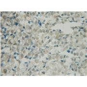 BRSK1 Rabbit Polyclonal Antibody (12673-1-AP)