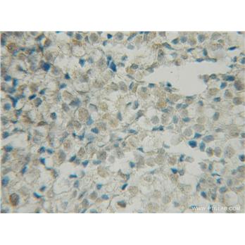 BRSK1 Rabbit Polyclonal Antibody (12673-1-AP)