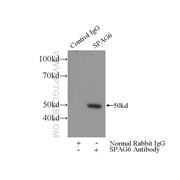 SPAG6 Rabbit Polyclonal Antibody (12462-1-AP)