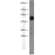 STAR Rabbit Polyclonal Antibody (12225-1-AP)