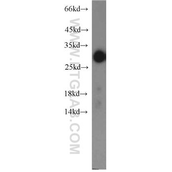 STAR Rabbit Polyclonal Antibody (12225-1-AP)