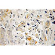 RTKN Rabbit Polyclonal Antibody (12762-1-AP)
