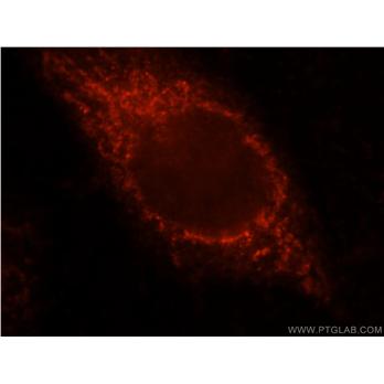 VPS33B Rabbit Polyclonal Antibody (12195-1-AP)