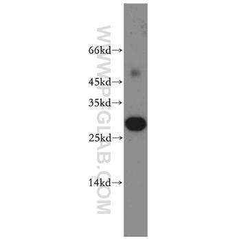 ASPRV1 Rabbit Polyclonal Antibody (13052-1-AP)