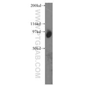 TGS1 Rabbit Polyclonal Antibody (13034-1-AP)