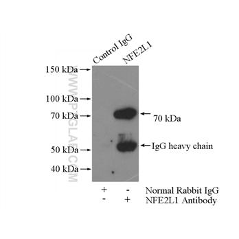 NFE2L1 Rabbit Polyclonal Antibody (12936-1-AP)