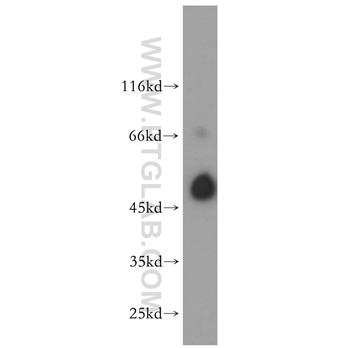ALG1 Rabbit Polyclonal Antibody (12872-1-AP)