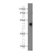 DYRK4 Rabbit Polyclonal Antibody (12890-2-AP)