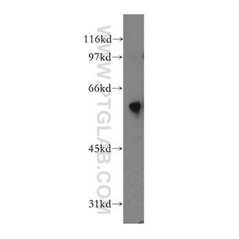 DYRK4 Rabbit Polyclonal Antibody (12890-2-AP)