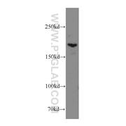 THADA Rabbit Polyclonal Antibody (12909-1-AP)