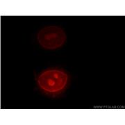 RPIA Rabbit Polyclonal Antibody (13010-1-AP)