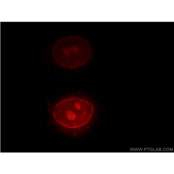RPIA Rabbit Polyclonal Antibody (13010-1-AP)