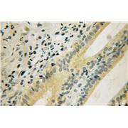 DUSP19 Rabbit Polyclonal Antibody (12924-1-AP)