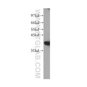 FBP1 Rabbit Polyclonal Antibody (12842-1-AP)