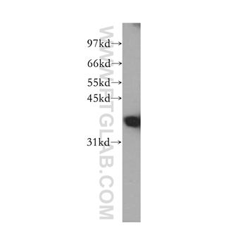 FBP1 Rabbit Polyclonal Antibody (12842-1-AP)