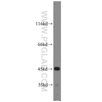 CYP2W1 Rabbit Polyclonal Antibody (12904-1-AP)