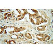 GNS Rabbit Polyclonal Antibody (13044-1-AP)
