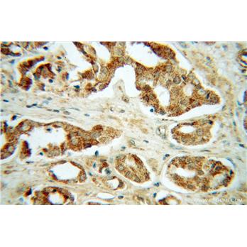 GNS Rabbit Polyclonal Antibody (13044-1-AP)
