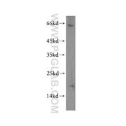 TXNL4B Rabbit Polyclonal Antibody (12927-1-AP)