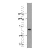 SACM1L Rabbit Polyclonal Antibody (13033-1-AP)