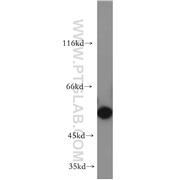 BBS4 Rabbit Polyclonal Antibody (12766-1-AP)