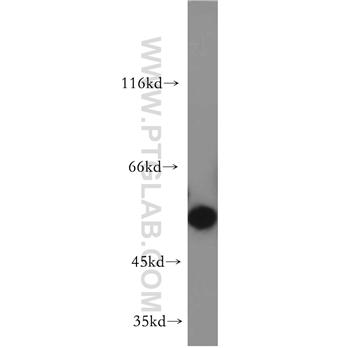 BBS4 Rabbit Polyclonal Antibody (12766-1-AP)