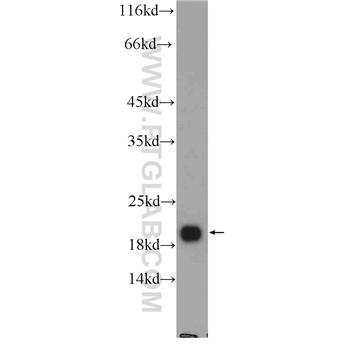 NCALD Rabbit Polyclonal Antibody (12925-1-AP)