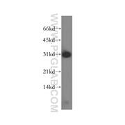 PSME2 Rabbit Polyclonal Antibody (12937-2-AP)