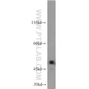 ILK Rabbit Polyclonal Antibody (12955-1-AP)