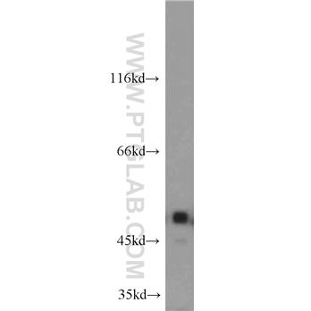 ILK Rabbit Polyclonal Antibody (12955-1-AP)