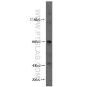 MEIS3 Rabbit Polyclonal Antibody (12775-1-AP)