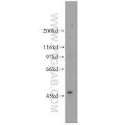 TFAP2A Rabbit Polyclonal Antibody (13019-3-AP)