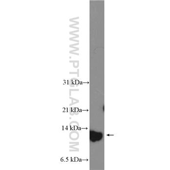 S100A7 Rabbit Polyclonal Antibody (13061-1-AP)