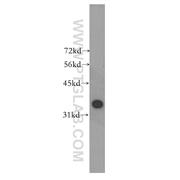 MAGEB4 Rabbit Polyclonal Antibody (12786-2-AP)