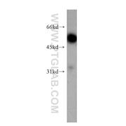 SYT9 Rabbit Polyclonal Antibody (12793-1-AP)